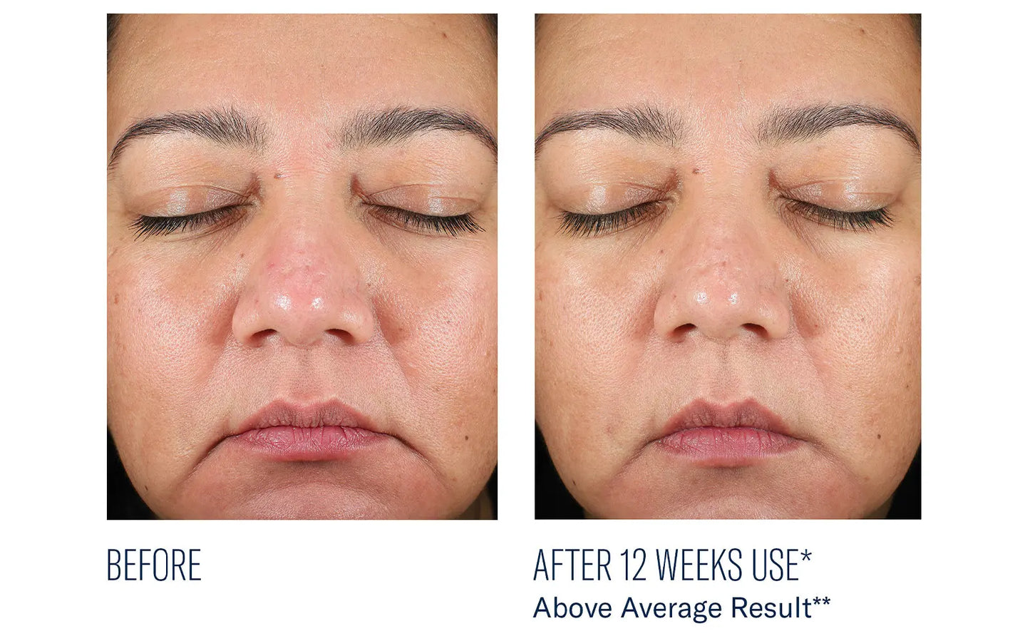 BioRewind Skin Health Dietary Supplement The Piazza Center for Plastic Surgery & Advanced Skincare