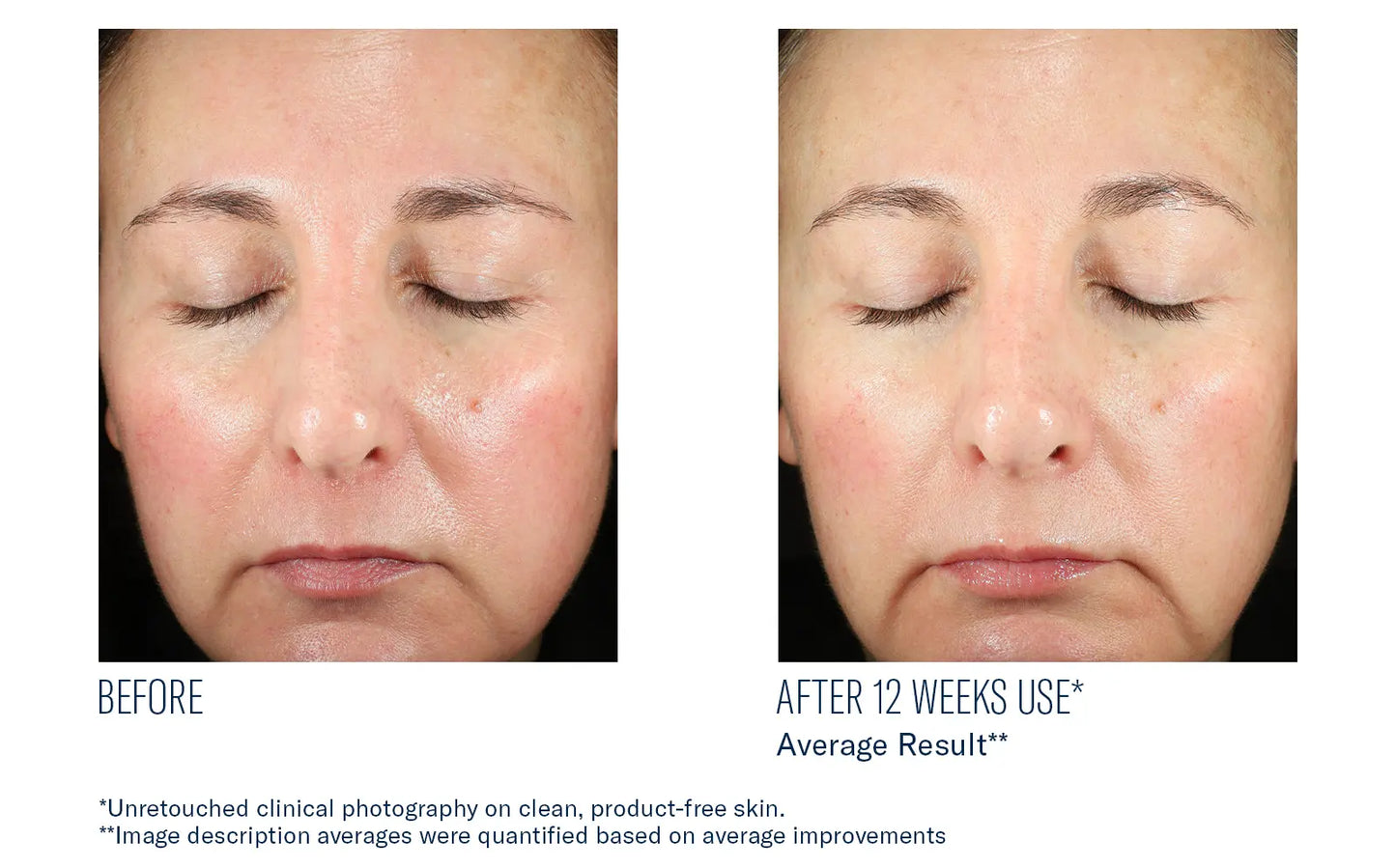 BioRewind Skin Health Dietary Supplement The Piazza Center for Plastic Surgery & Advanced Skincare
