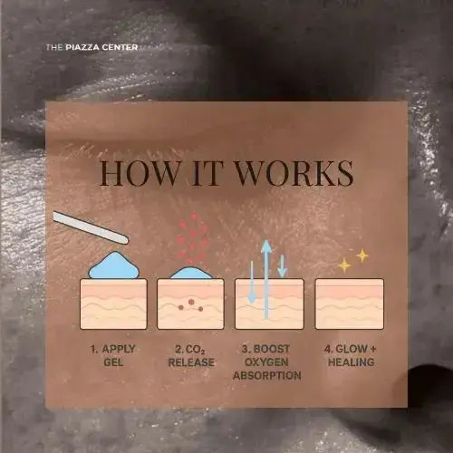 Diagram Explaining CO2 Mask From Dr Medion