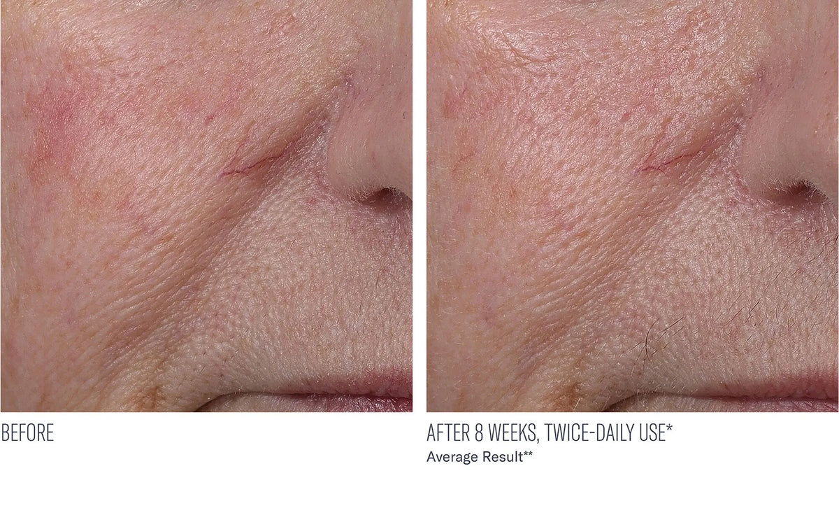 Skinbetter Science InterFuse Treatment Cream Face & Neck at The Piazza Center