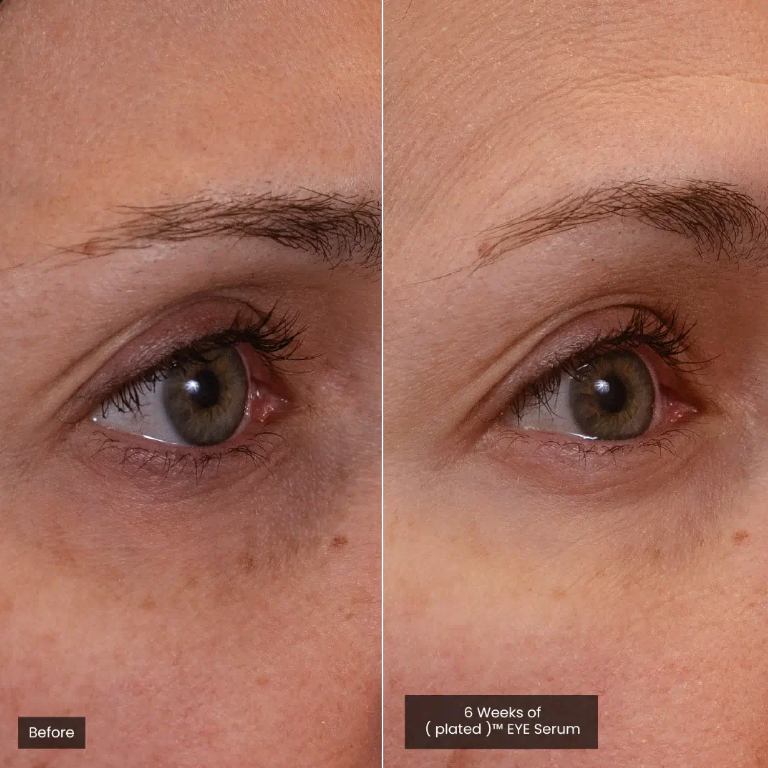 Plated Eye Serum Before and After Eye Results