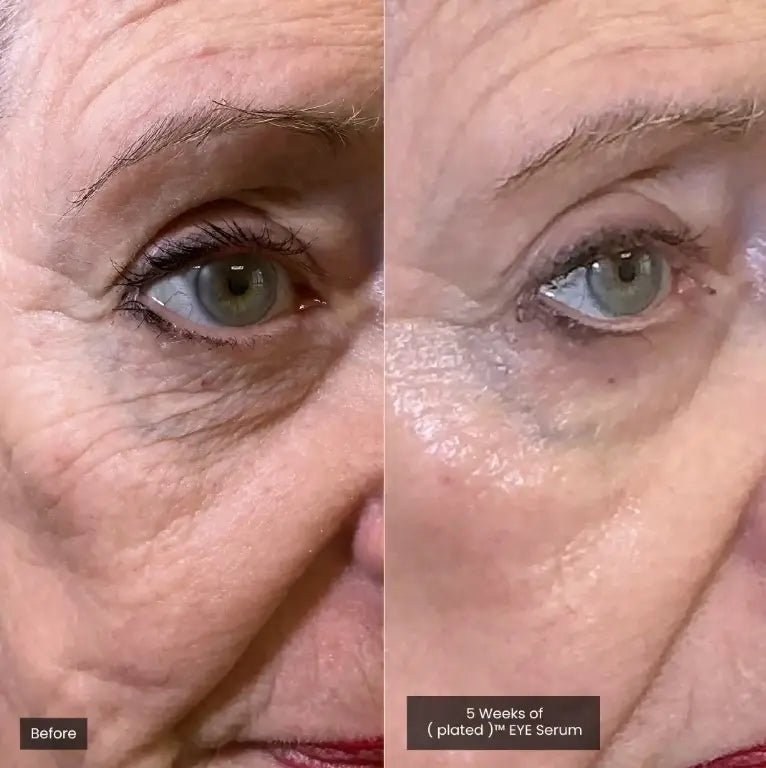 Plated Eye Serum Before and After Eye Results