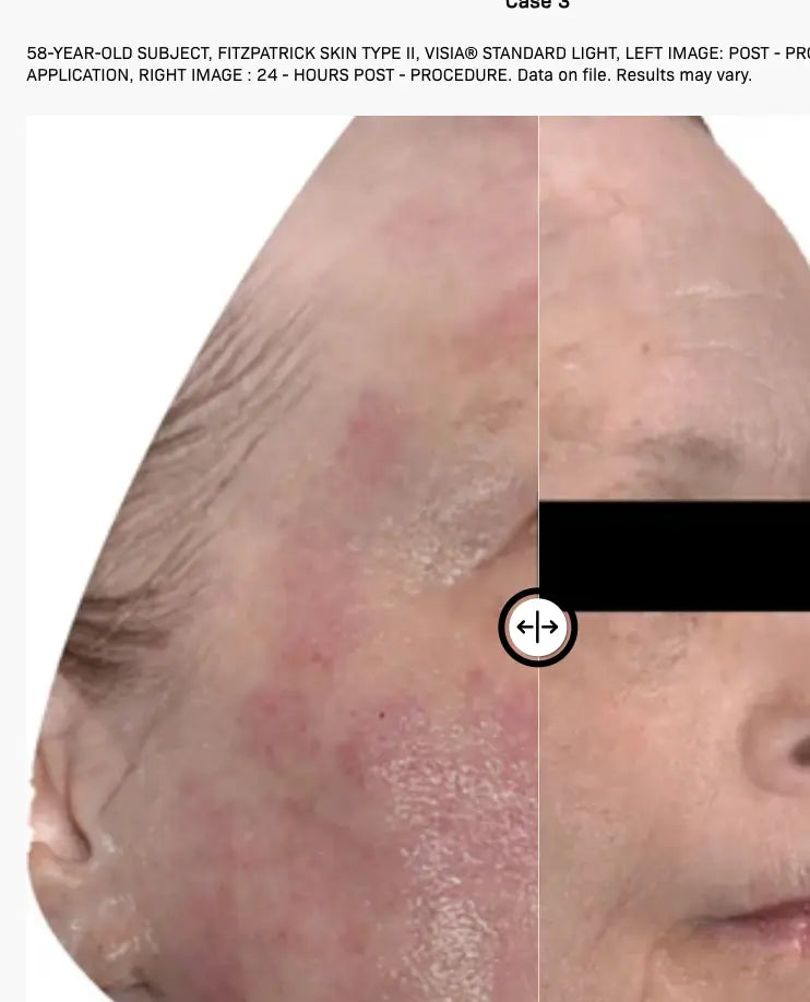 Before & After