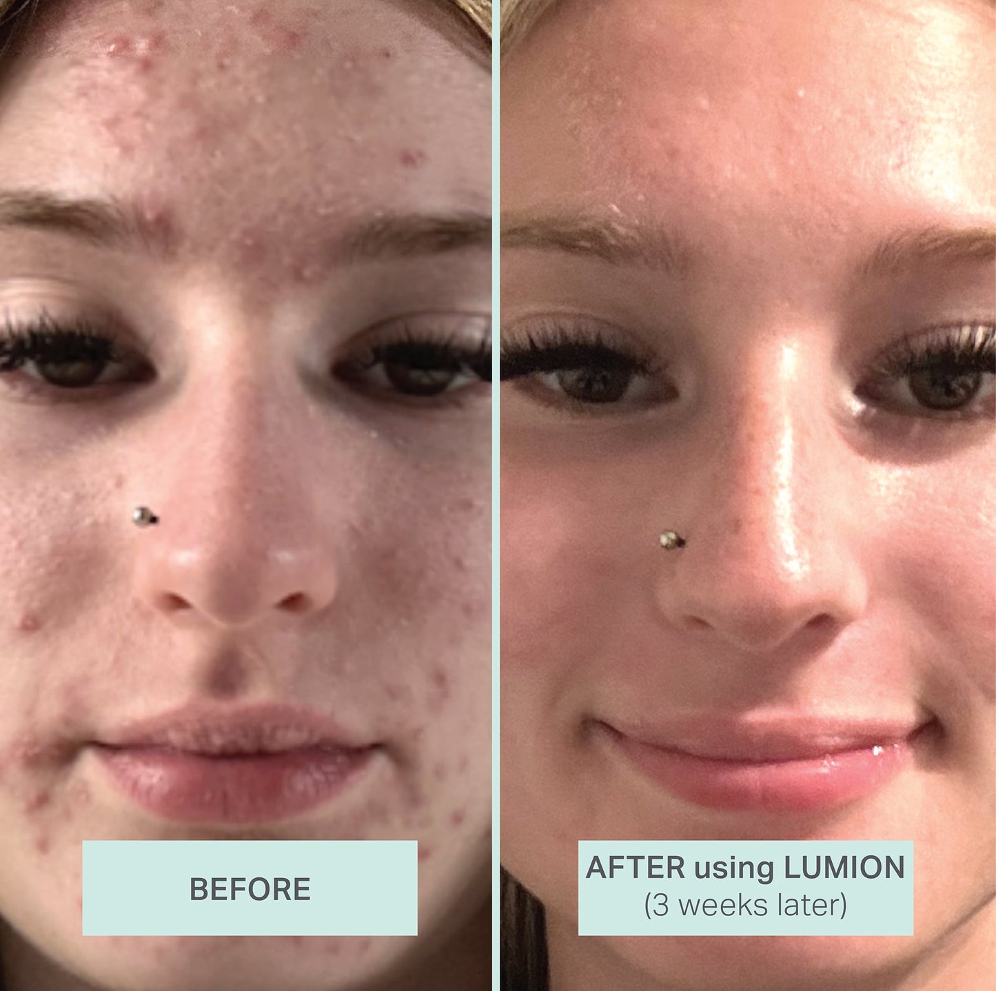 Miracle Mask