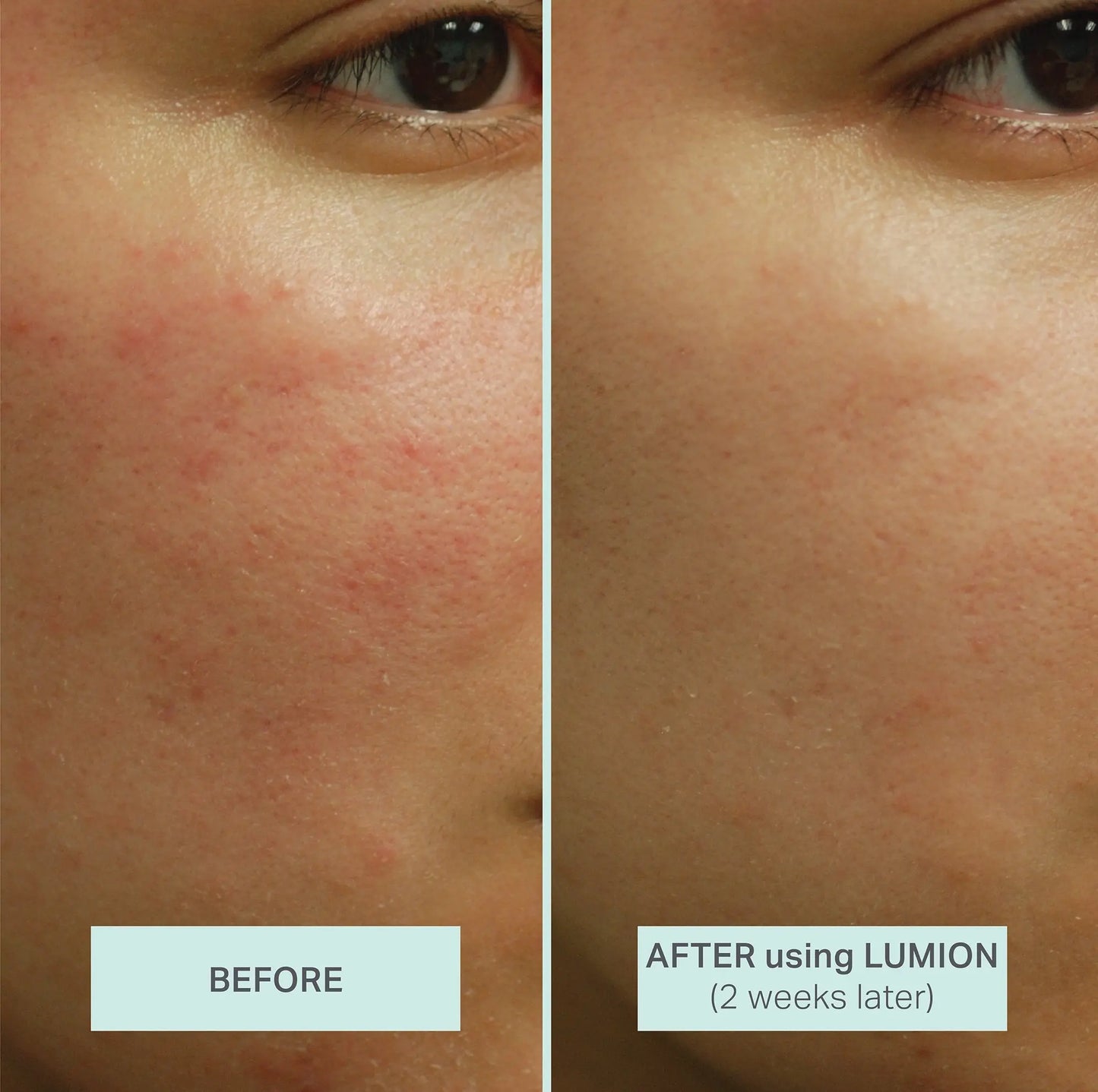 Miracle Mist LUMION skin