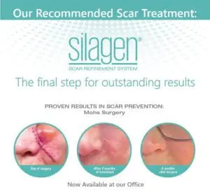 Silagen 100% Silicone Scar Healing Gel - 15g The Piazza Center for Plastic Surgery & Advanced Skincare