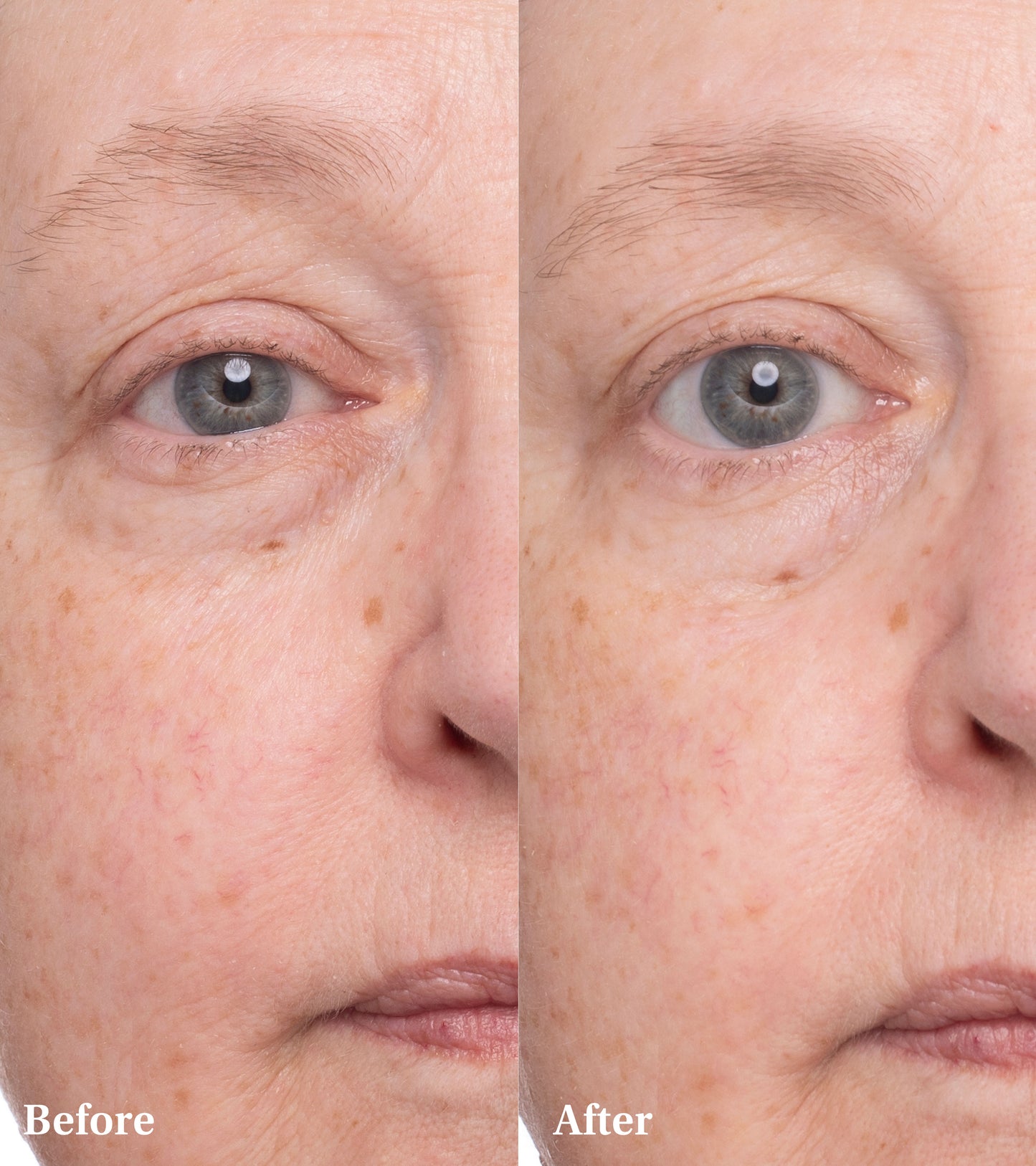 Dr Medion Spaoxy Gel Before and After