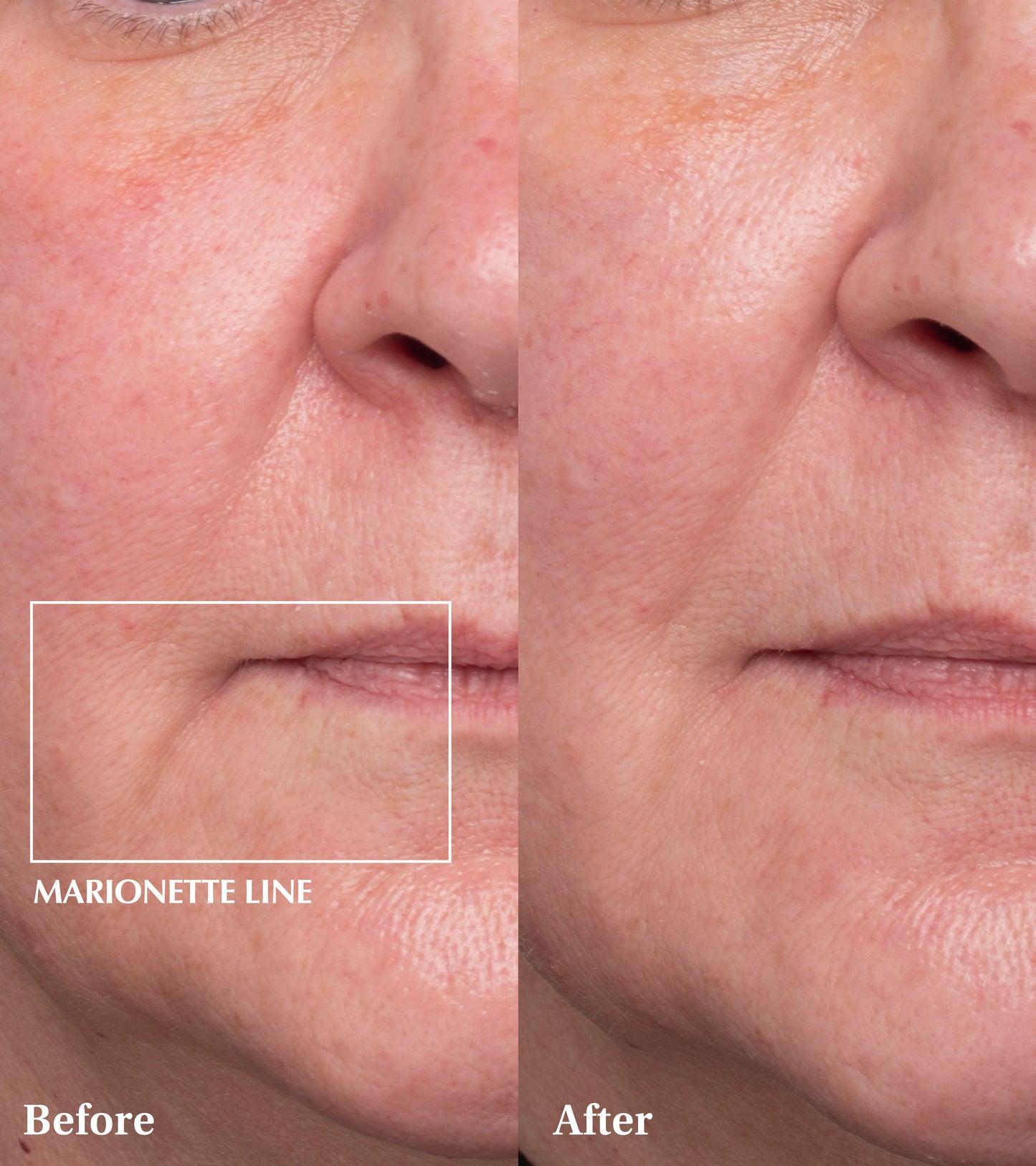 Dr Medion Spaoxy Gel Before and After