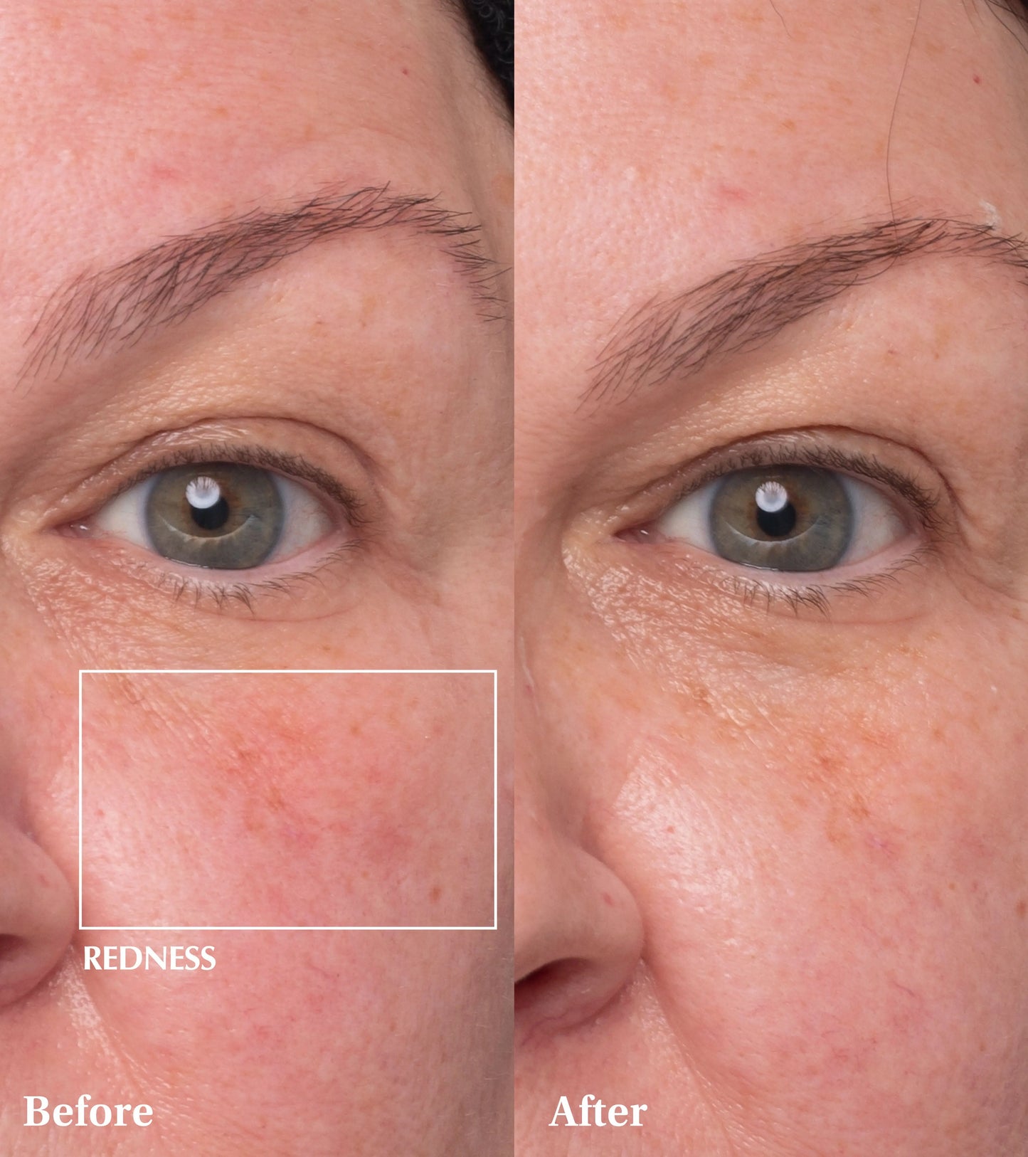Dr Medion Spaoxy Gel Before and After
