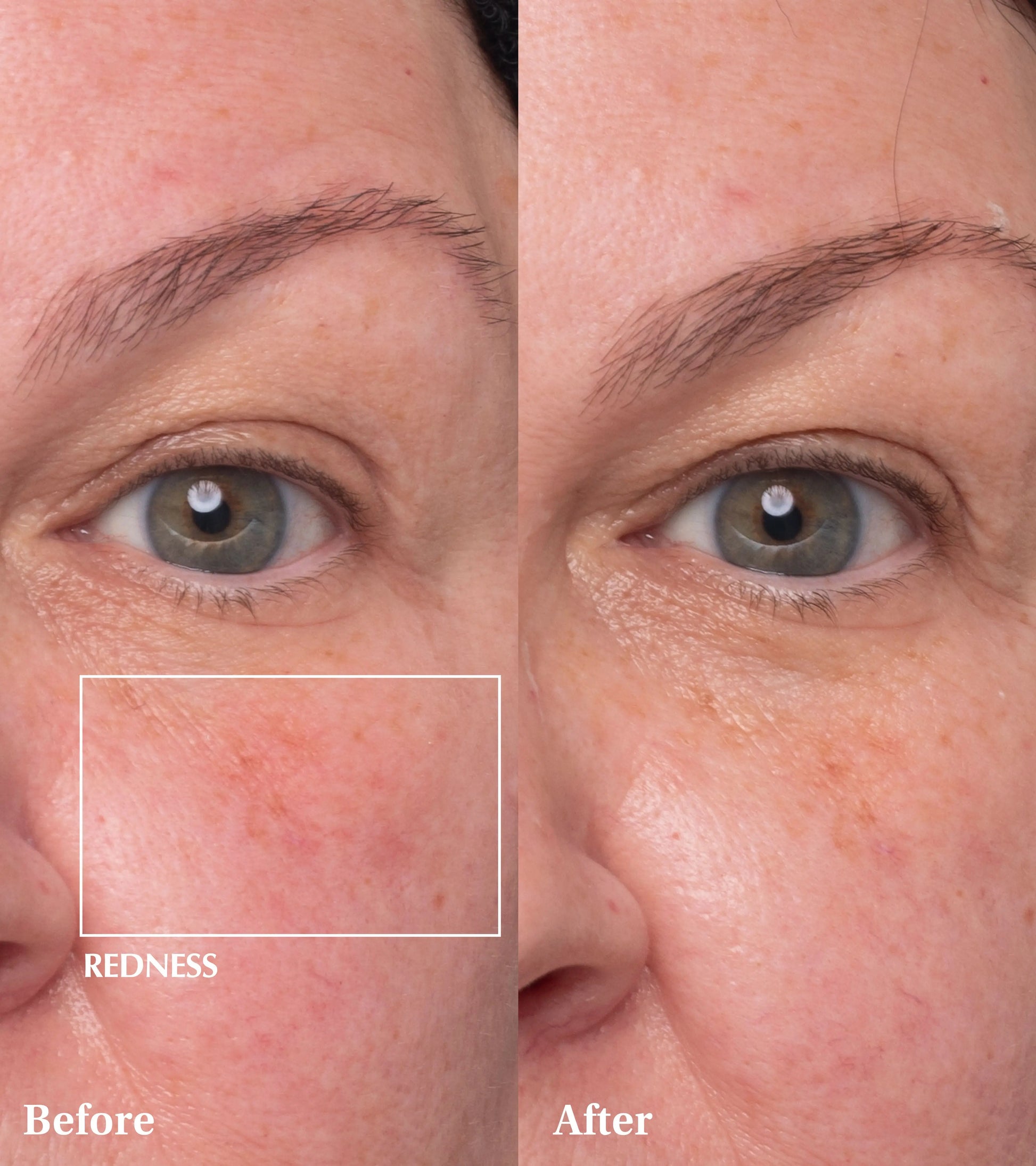 Dr Medion Spaoxy Gel Before and After