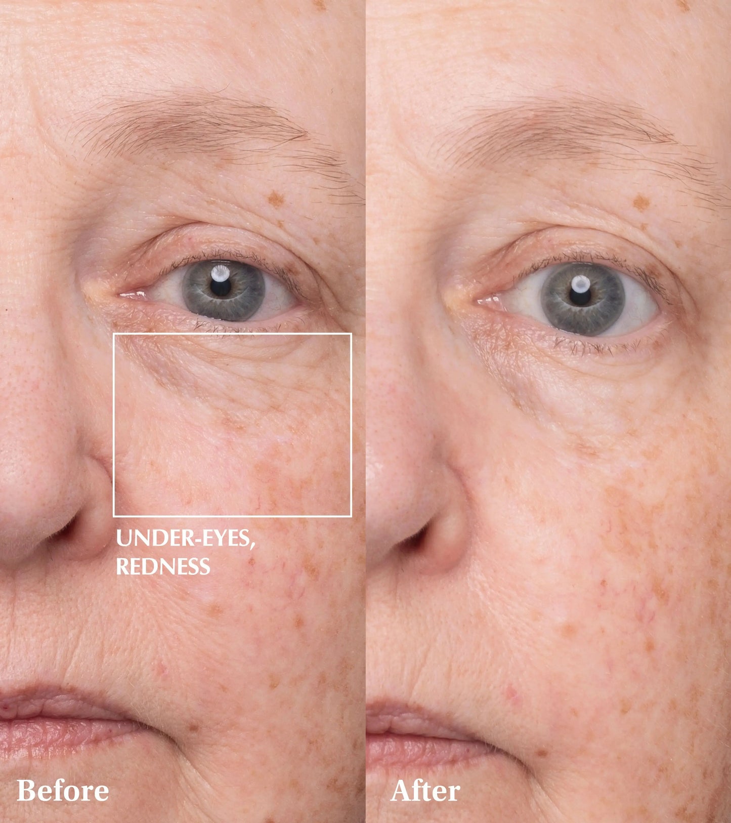Dr Medion before and after results