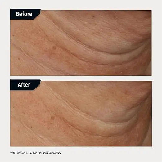 nectifirm before and after