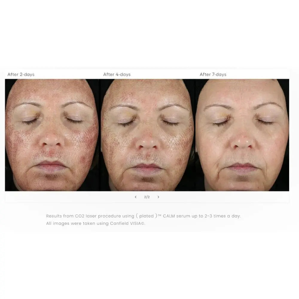 Before and after using Plated Calm post-procedure cream. Individual results may vary.
