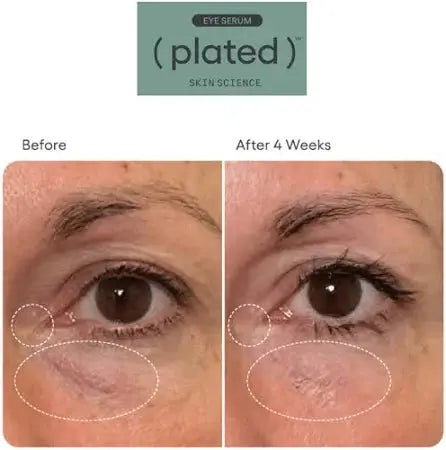 Plated Eye Serum Before and After Eye Results