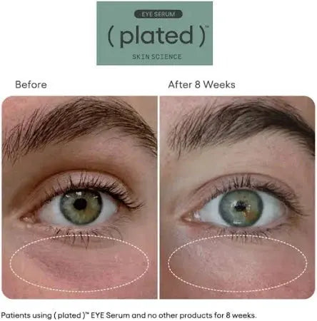 Plated Eye Serum Before and After Eye Results