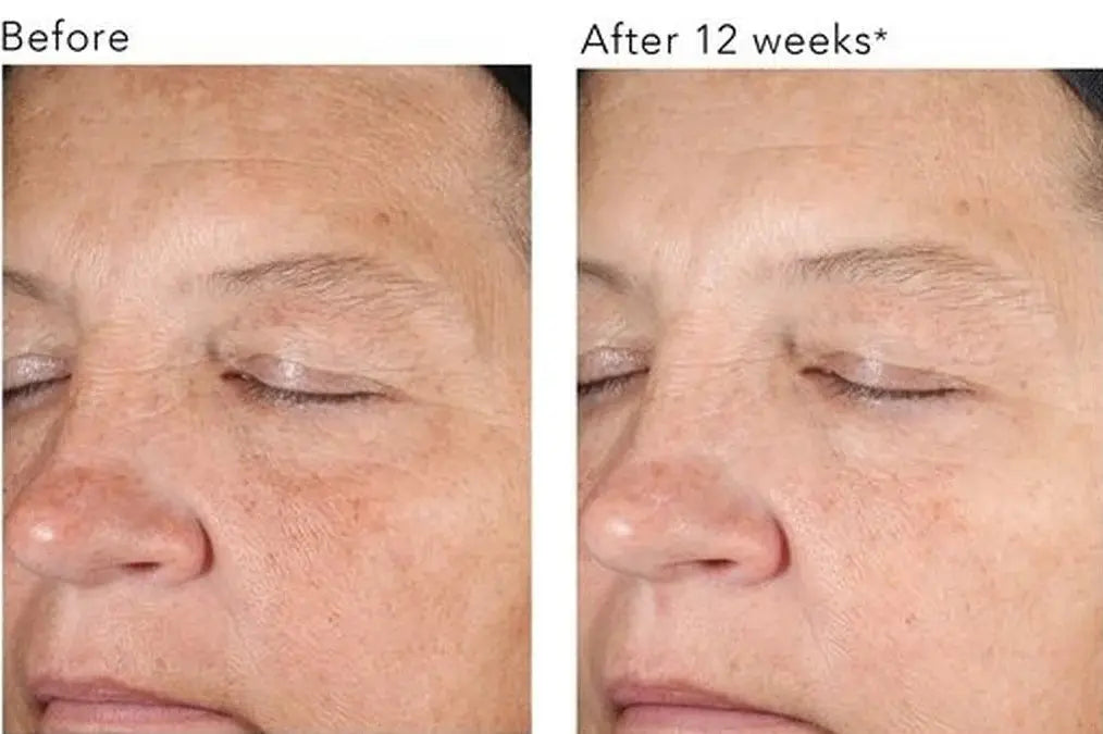 Revision Skincare® D·E·J Night Face Cream My Store