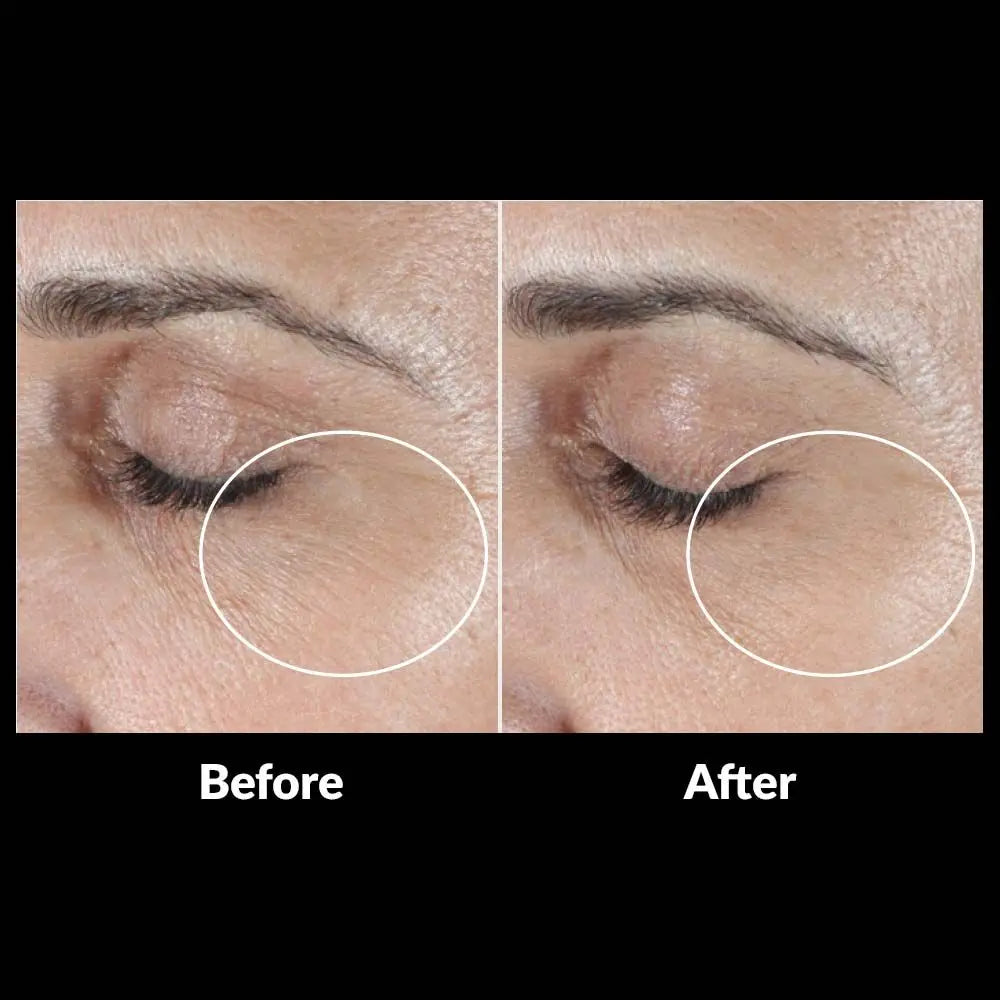 SkinMedica® HA5 Rejuvenating Hydrator My Store