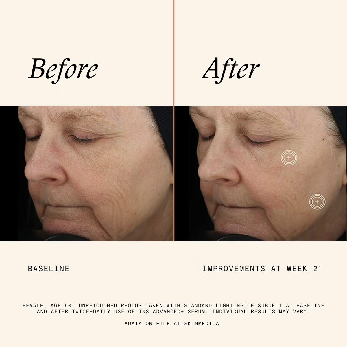 Skinmedica Before and After Results