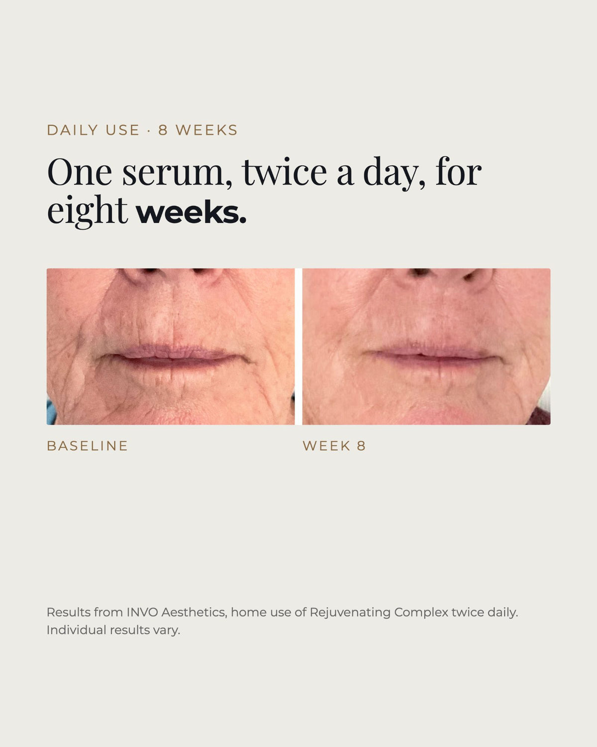 Before and after 8 weeks of twice-daily INVO Rejuvenating Complex home use. Results from INVO Aesthetics; individual results vary.