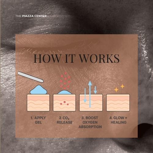 Diagram Explaining CO2 Mask From Dr Medion
