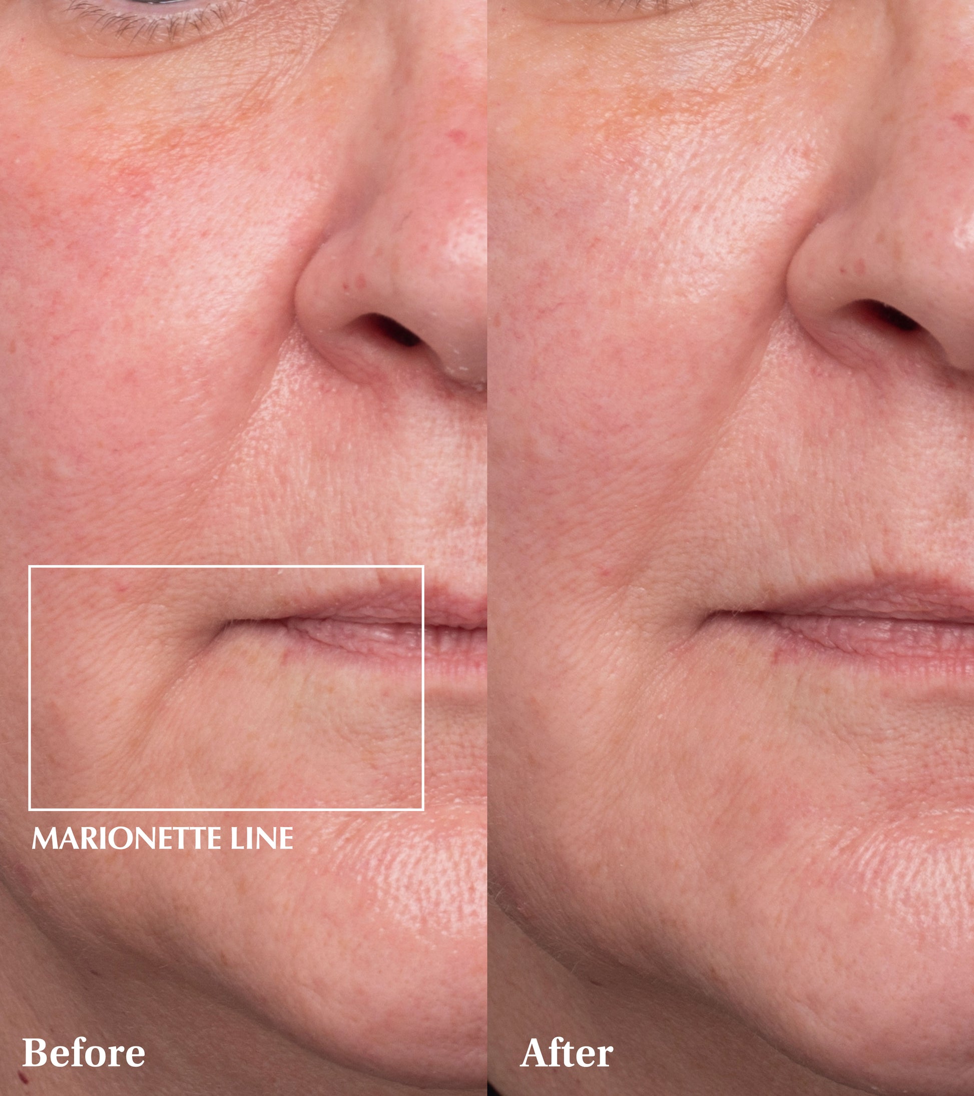 Dr Medion Spaoxy Gel Before and After