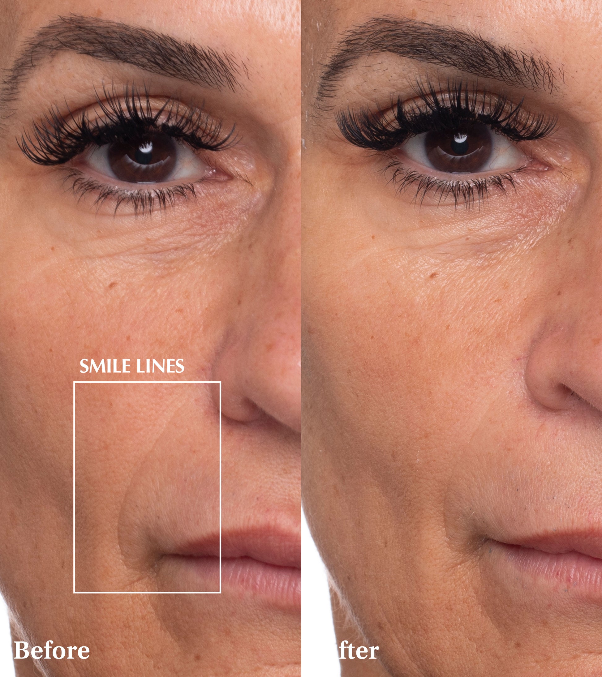 Dr Medion Spaoxy Gel Before and After