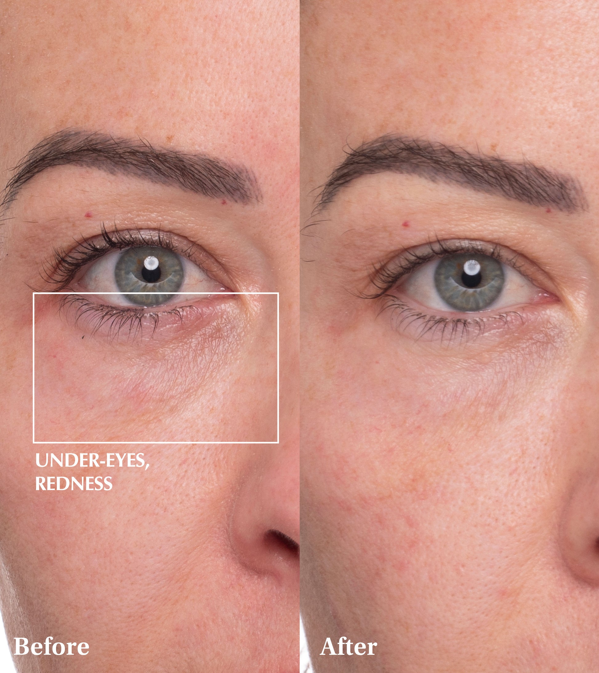 Dr Medion Spaoxy Gel Before and After