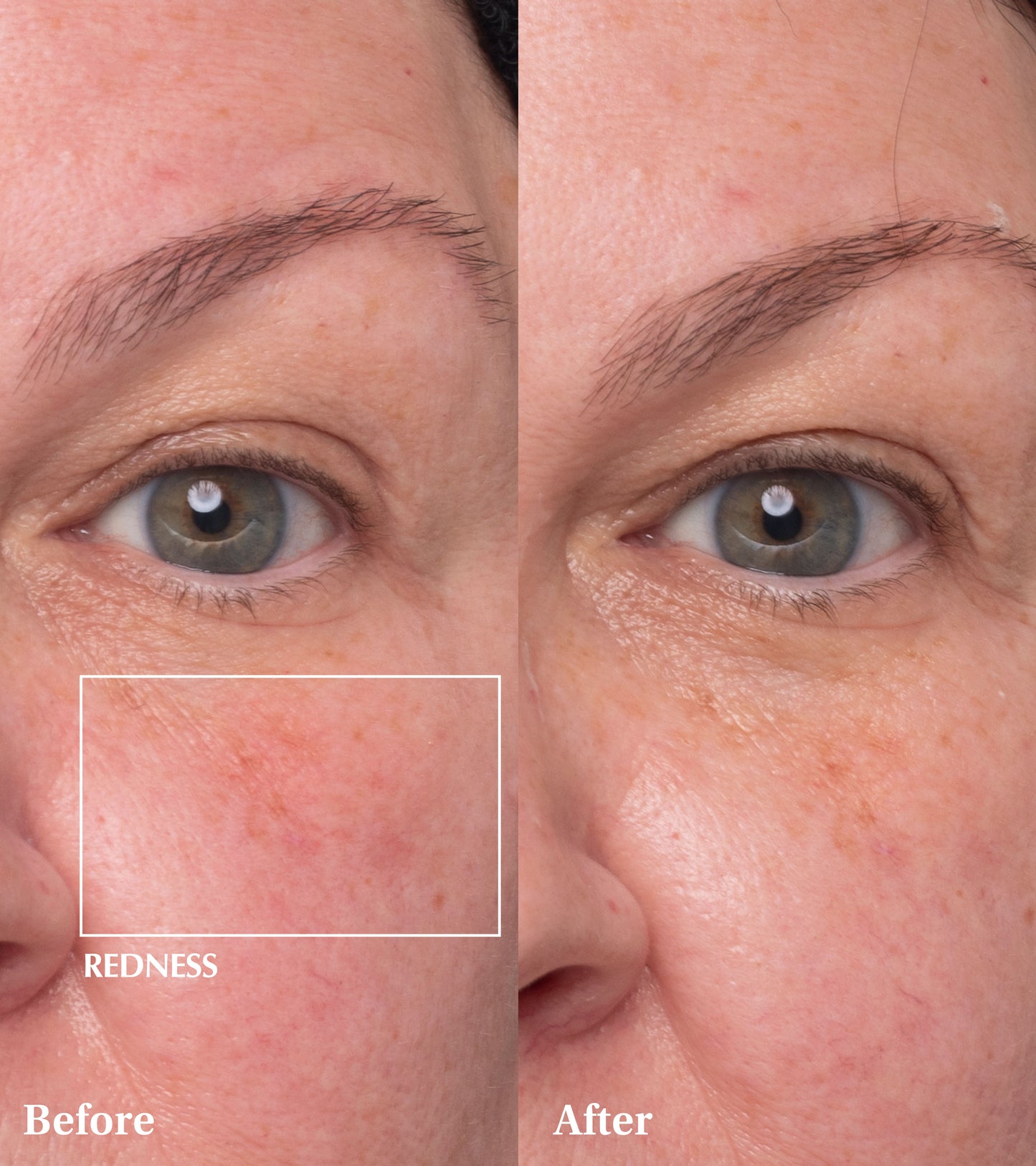 Dr Medion Spaoxy Gel Before and After