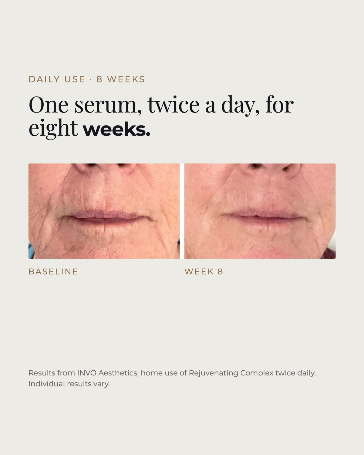 Before and after 8 weeks of twice-daily INVO Rejuvenating Complex home use. Results supplied by INVO Aesthetics; individual results vary.