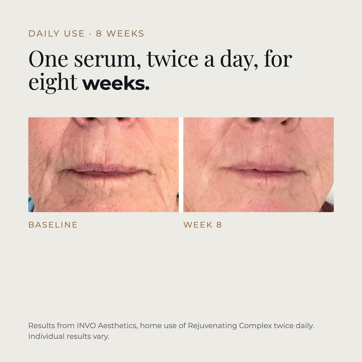Before and after 8 weeks of twice-daily INVO Rejuvenating Complex home use. Results from INVO Aesthetics; individual results vary.