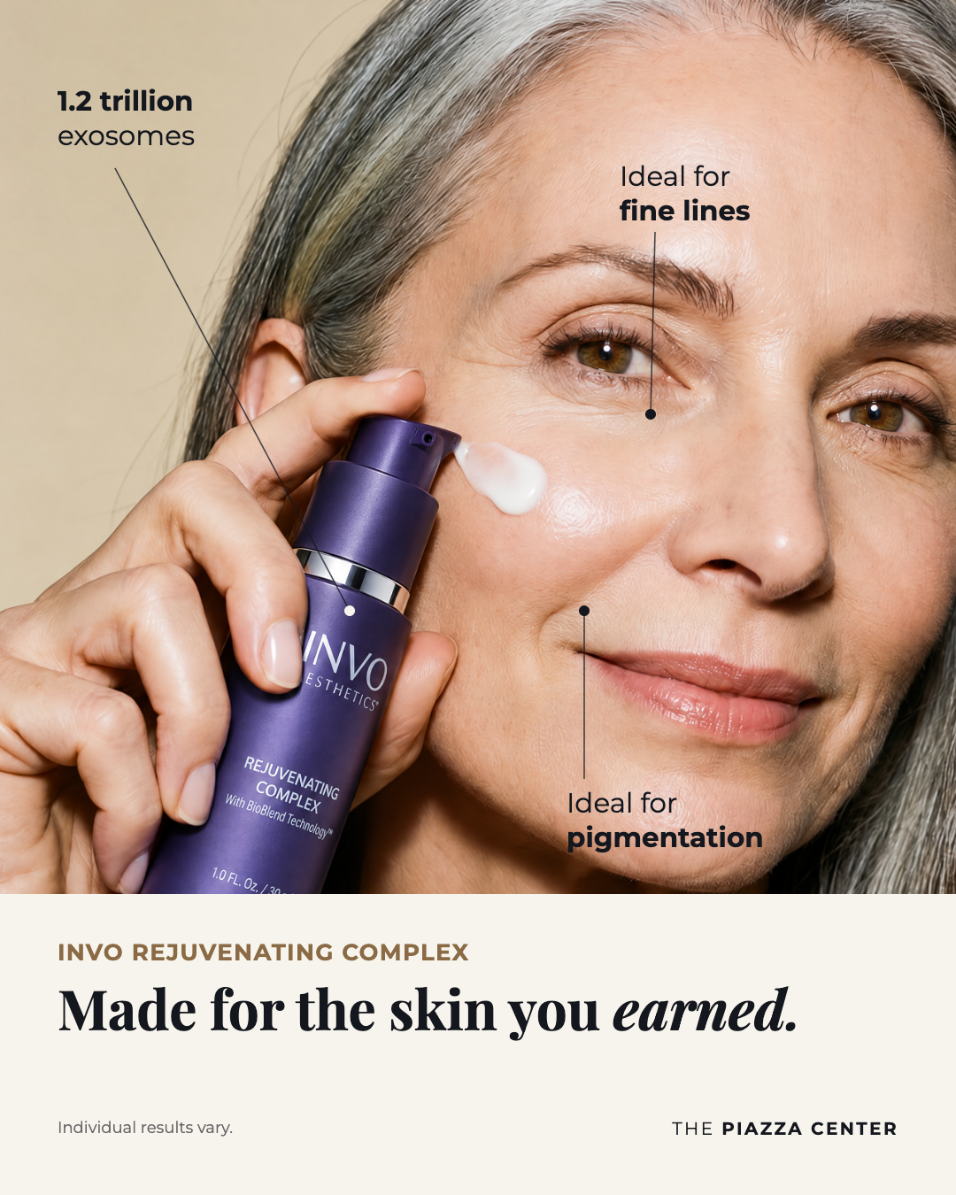 Woman applying INVO Rejuvenating Complex exosome serum to her cheek, with callouts for fine lines and pigmentation