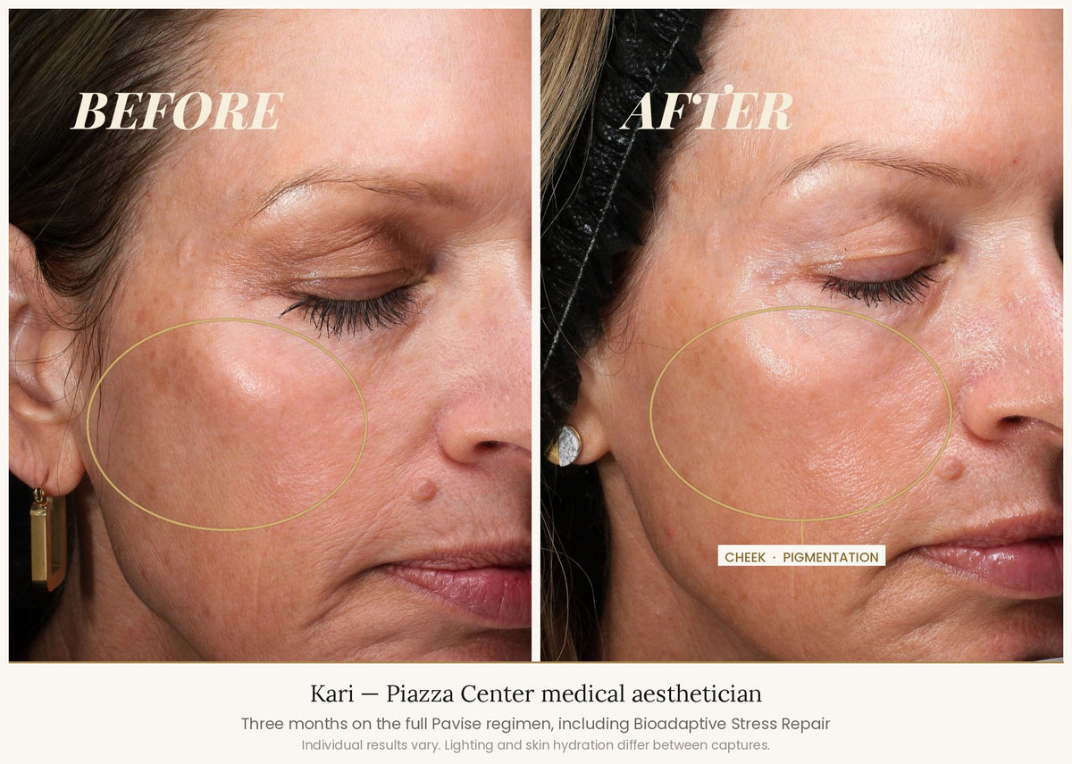 Pavise Bioadaptive Stress Repaire before and after with Visia 