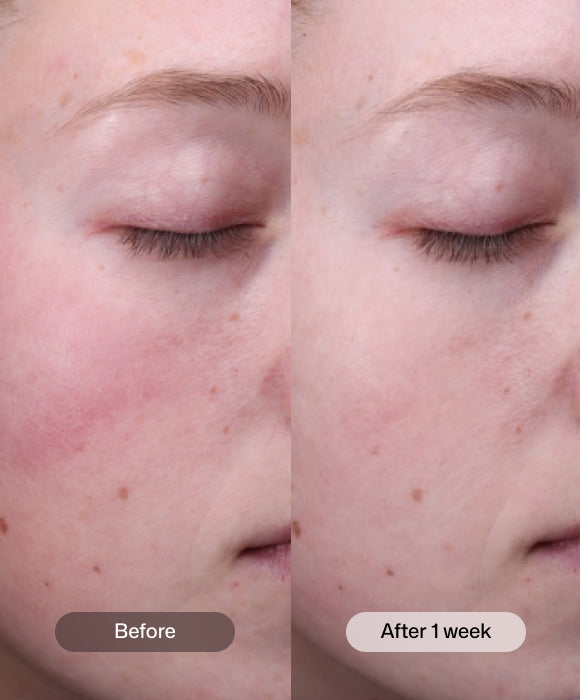 Radiance+ Resurfacing Serum benefits